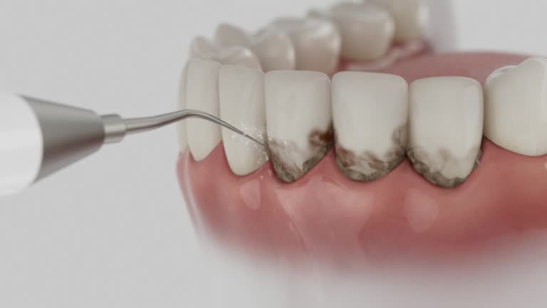Reliable Dental Implants contractor in McColl, SC by Smile Center Dentistry